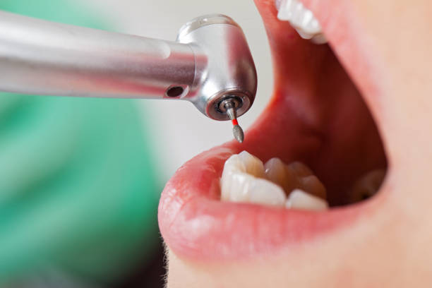 Best Emergency Dental Care for Sports Injuries in Lake Darby, OH